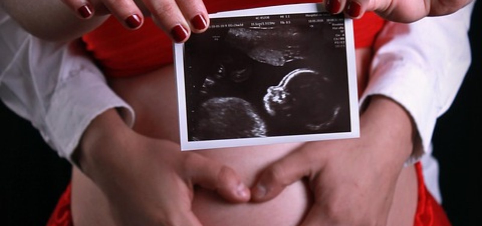 pregnancy-3590794_960_720.jpg